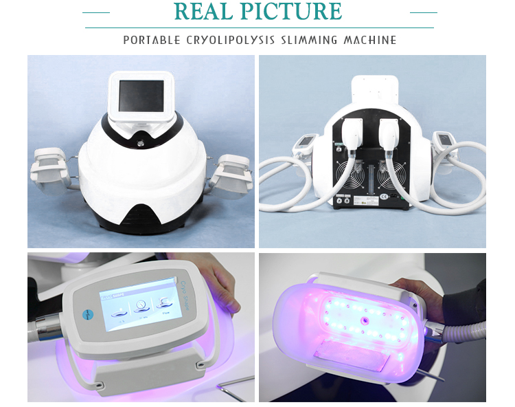 Cheap Price Weight Loss Portable Cryo Slimming Machine To Buy