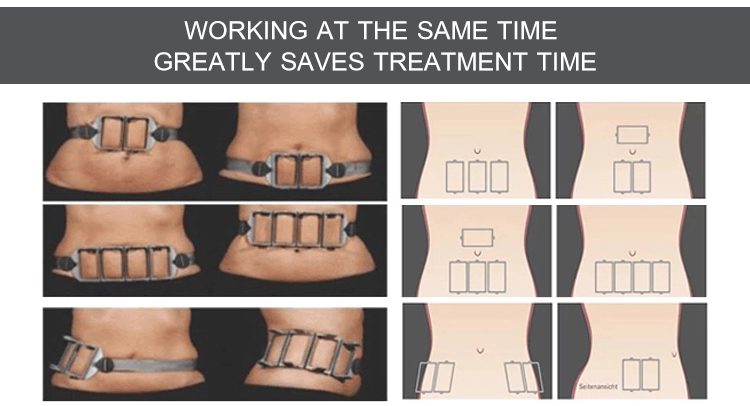 Body Slimming Diode Laser 1060nm Non-Invasive Laser Body Sculpting Machine For Fat Removal