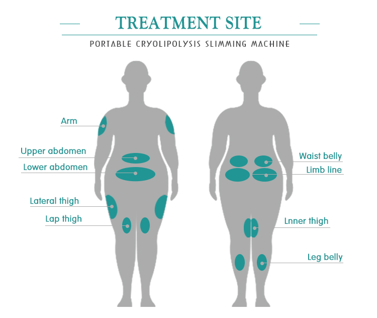 Cheap Price Weight Loss Portable Cryo Slimming Machine To Buy