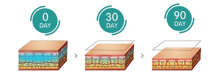 Cheap Price Weight Loss Portable Cryo Slimming Machine To Buy